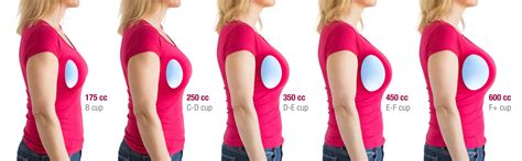 4 Fashion Tips to Show Off Your New Breast Implants